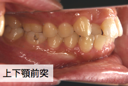症例解説