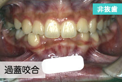 症例解説